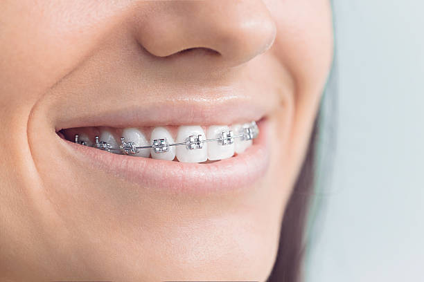 Best Veneers and Lumineers  in Easton, MD
